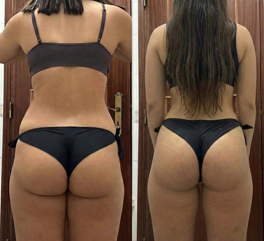 Client back-view before and after
