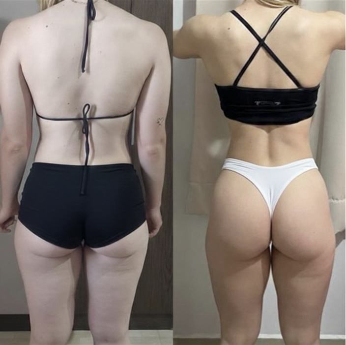 Client back-view before and after