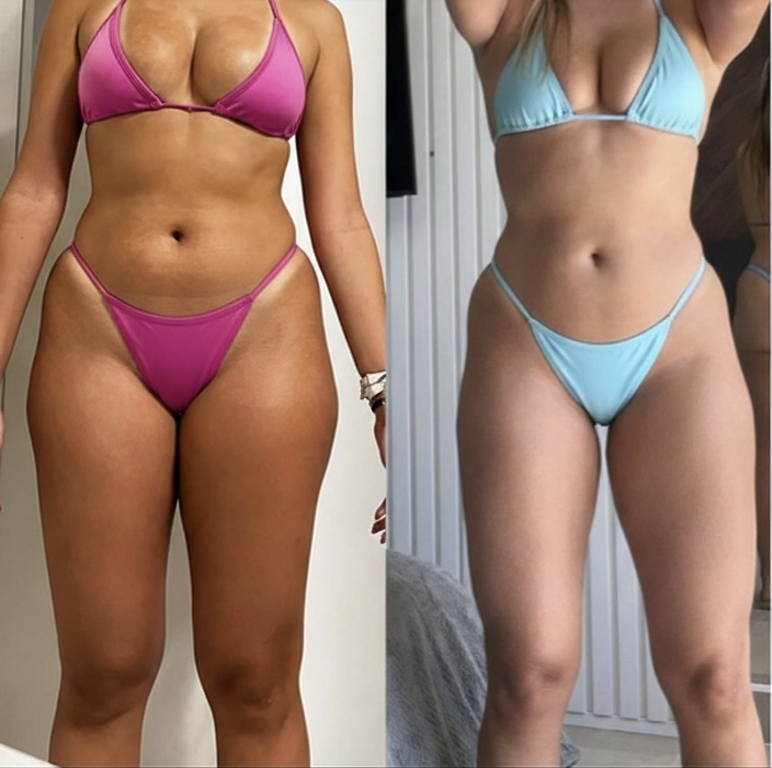 Client front-view before and after