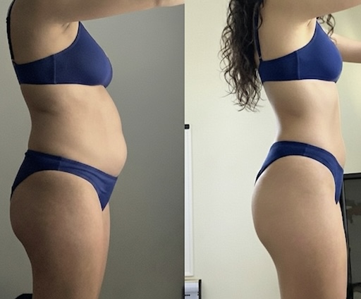 Client side-view before and after