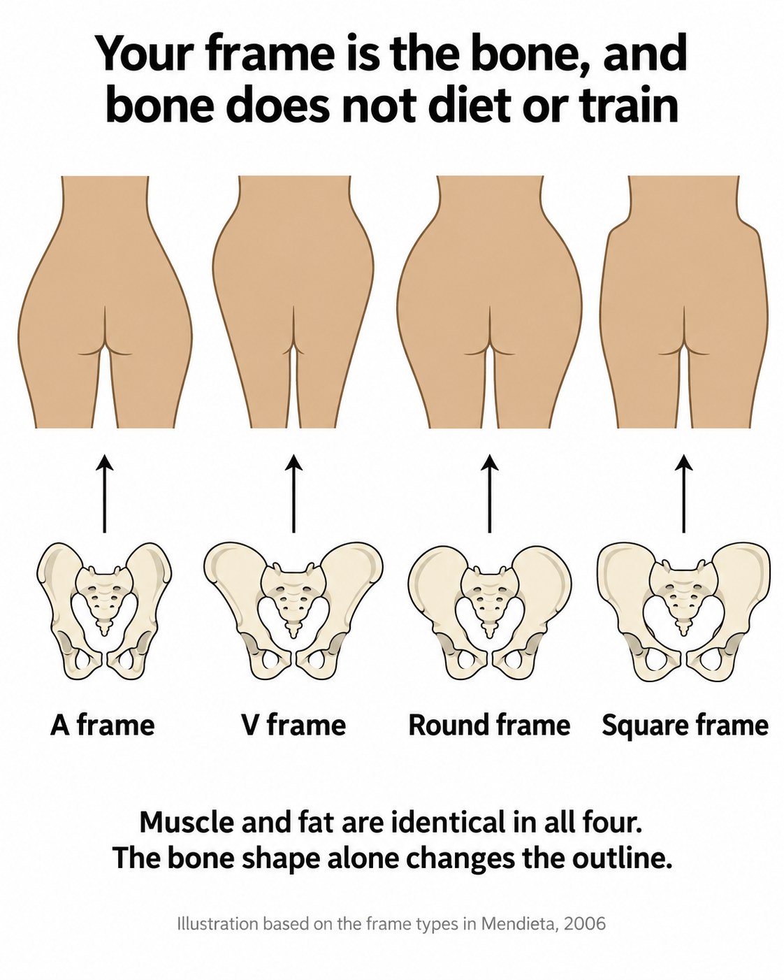 Four hip silhouettes labelled A frame, V frame, round frame and square frame, each shown with the pelvis bone shape that produces it.