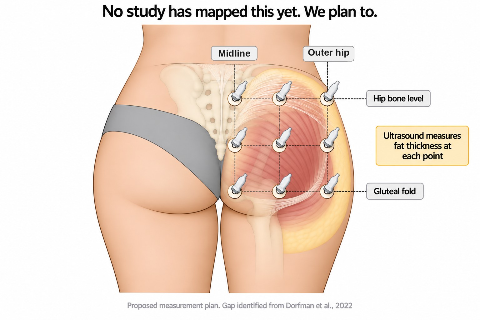 Proposed ultrasound measurement plan showing a three by three grid of nine measurement points across one buttock, from hip bone level to the gluteal fold.
